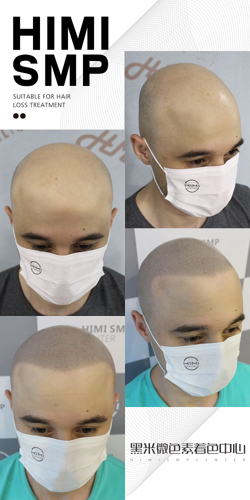 纹发安全可靠吗?符合标准的纹发设备让纹发更安全!